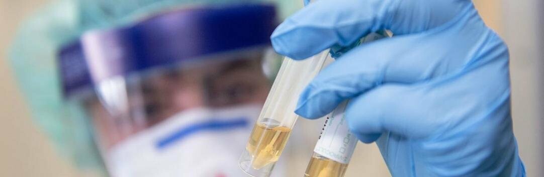 За сутки в Запорожской области коронавирусом заболели 458 человек За сутки в Запорожской области коронавирусом заболели 458 человек, Ева Миронова